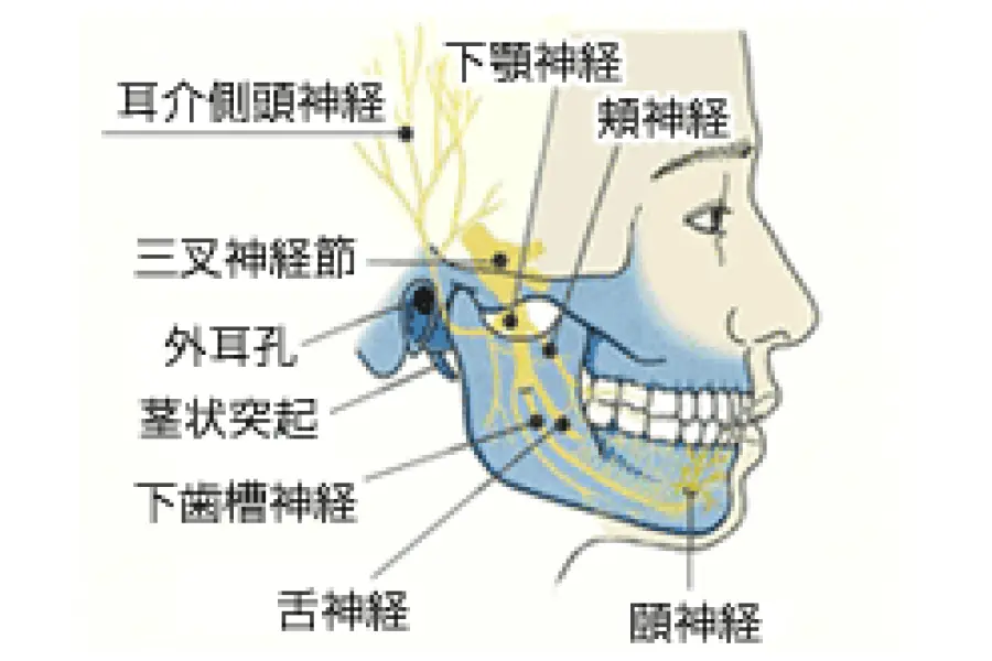 三叉神経照射例